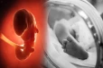இந்தியாவில் அதிர்ச்சி சம்பவம்: இரண்டு மாத ஆண் குழந்தையின் வயிற்றில் கரு