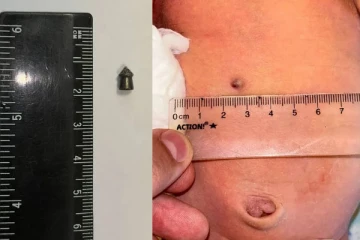 தவறுதலாக நிறைமாத கர்ப்பிணிப்பெண்ணை சுட்ட கணவர்: குழந்தை பிறந்தபோது