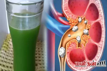 சிறுநீரக கல் கரைந்து வெளியேறணுமா? இந்த மூலிகையில் ஒரு ஜூஸ் குடிச்சா போதும்
