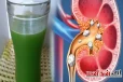 சிறுநீரக கல் கரைந்து வெளியேறணுமா? இந்த மூலிகையில் ஒரு ஜூஸ் குடிச்சா போதும்