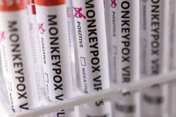 monkeypox தொற்றிலிருந்து வேகமாக மீள வேண்டுமா? கட்டாயம் இந்த 5 உணவுகளை சாப்பிடுங்க