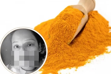 திருமண கொண்டாத்தில் மஞ்சள் பூசியதால் உயிரிழந்த மணப்பெண்: உயிருக்கு போராடும் மணமகன்