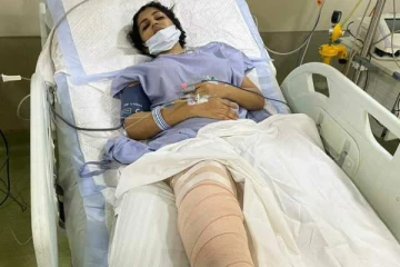 பல எலும்பு முறிவுகளால் நடிகை யாஷிகாவுக்கு அறுவை சிகிச்சை! பலத்த காயத்துக்குள்ளான அவரின் தற்போதைய மனதை உருக்கும் புகைப்படம்