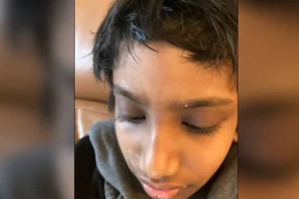 மாணவனின் தலைமுடியை வெட்டிய பாடசாலை: கோபமடைந்த பெற்றோர் | Toronto School Cuts Student S Hair Angry Parents