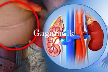 කොළඹ තවත් වකුගඩු ජාවාරමක් ගැන අනාවරණයක්.