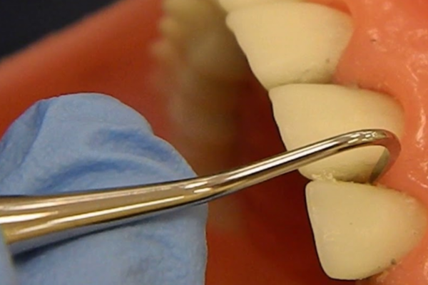 பற்களில் மஞ்சள் கறையை உண்டாக்கி அரிப்பை ஏற்படுத்தும் உணவுகள்...இனி எச்சரிக்கையா இருங்க? | Foods And Drinks That Can Stain Your Teeth