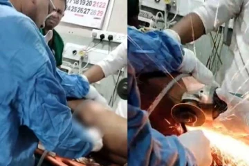 අදහාගත නොහැකි සැත්කමක් බදුල්ල මහ රෝහලෙන්