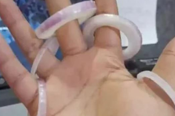 ஆசை ஆசையாய் ஆனியன் ரிங்ஸ் ஆர்டர் செய்த இளைஞர்....பார்சலை பிரித்த போது காத்திருந்த அதிர்ச்சி | Delhi Man Orders Onion Rings Viral Video