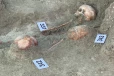 செம்மணியில் இன்று 12 மனித என்புக்கூடுகள் அடையாளம்