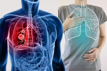 உலக நுரையீரல் புற்றுநோய் தினம் 2023: இந்த அறிகுறிகள் இருந்தால் எச்சரிக்கையாக இருங்கள்