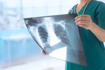 கதிரியக்க தொழில்நுட்பவியலாளர்களுக்குப் பற்றாக்குறை!