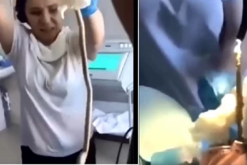 பெண்ணின் வாய் வழியாக 4 அடி நீள பாம்பை வெளியே எடுக்கும் மருத்துவர்: வைரல் வீடியோ