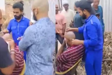 வழுக்கை தலையில் முடி வளர தேய்க்கப்பட்ட லோஷனால் உடல்நல பாதிப்பு