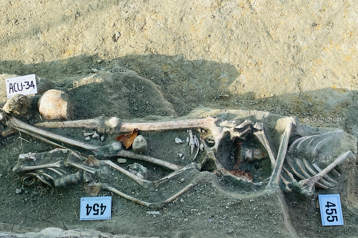 செம்மணியில் இன்று 04 என்புக் கூடுகள் அடையாளம் | 04 Skeletons Identified In Semmani Today செம்மணியில் இன்று 04 என்புக் கூடுகள் அடையாளம் | 04 Skeletons Identified In Semmani Today