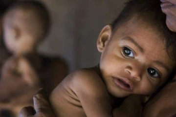 பொருளாதார நெருக்கடி - ஊட்டச்சத்து குறைபாடுள்ள சமூகம் உருவாகும் அபாயம்