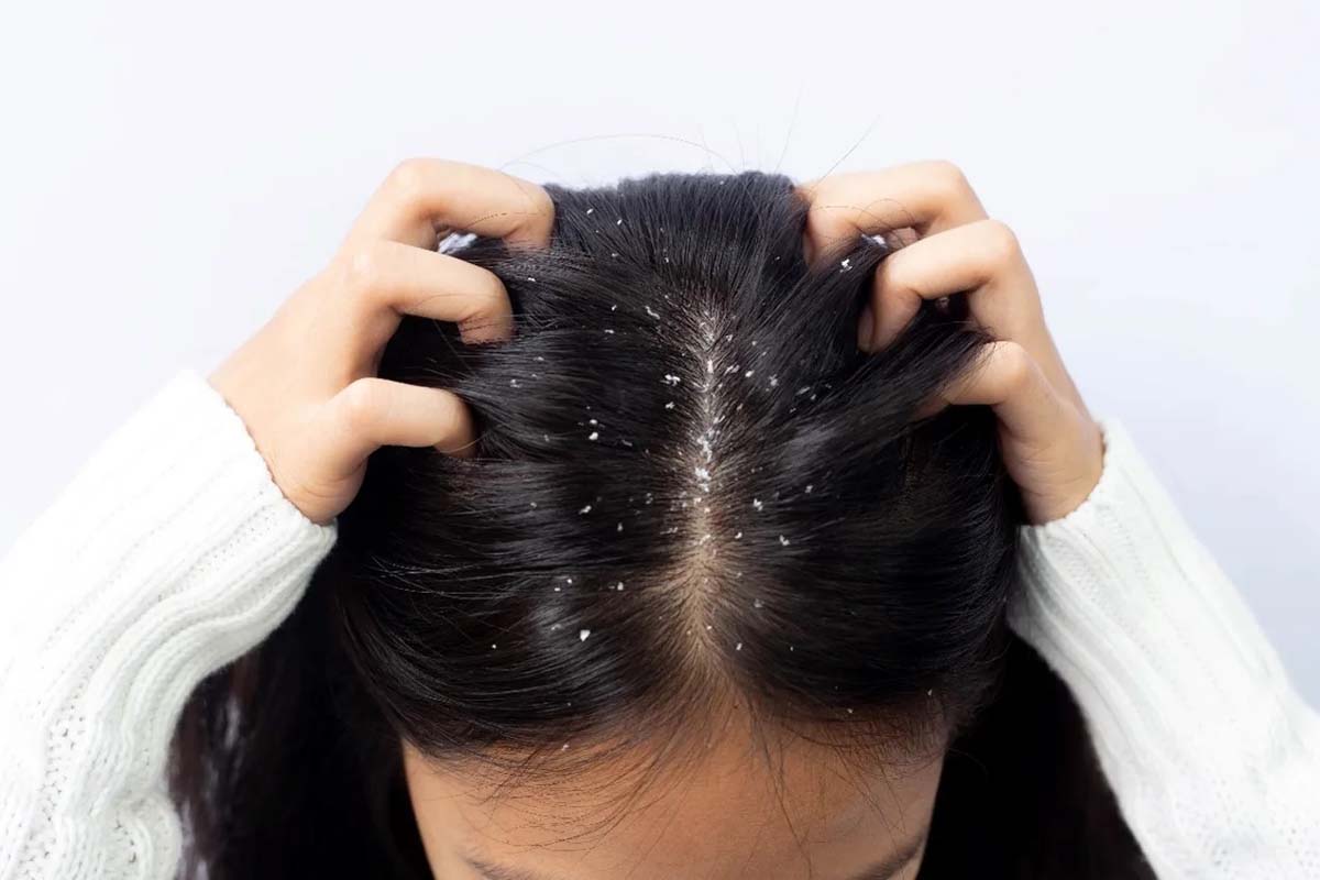 தினமும் தலைக்கு குளித்தால் முடி கொட்டுமா? பலரின் குழப்பத்திற்கு பதில் இதோ | Daily Hair Washing Growth Hair Problem