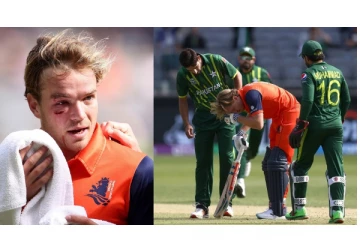 T20 உலக கோப்பை - பாக். வீரர் வீசிய பந்து முகத்தில் பட்டு காயமடைந்த பாஸ் டி லீட்..! வைரலாகும் வீடியோ