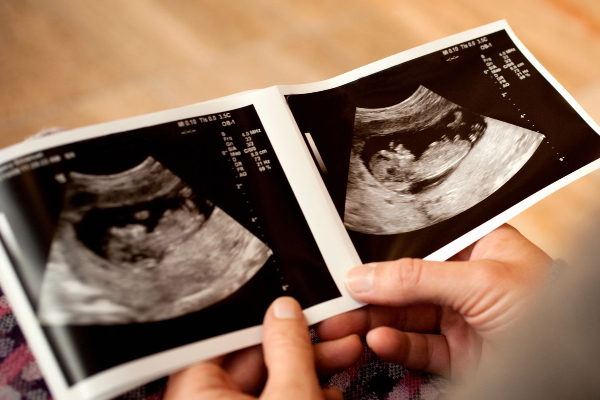 20 ஆண்டுகளுக்கு பின் உருவான கரு! 5 மாதத்தில் மருத்துவர்களுக்கு காத்திருந்த அதிர்ச்சி....பிறகு நடந்த அதிசயம் | Pregnant Woman After 20 Years Of Waiting Shock At