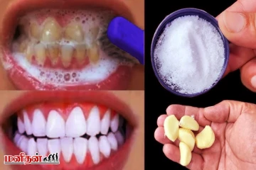 அடர் மஞ்சள் கறை படிந்த பற்களை 2 நிமிடத்தில் வெண்மையாக்க - இதை செய்ங்க