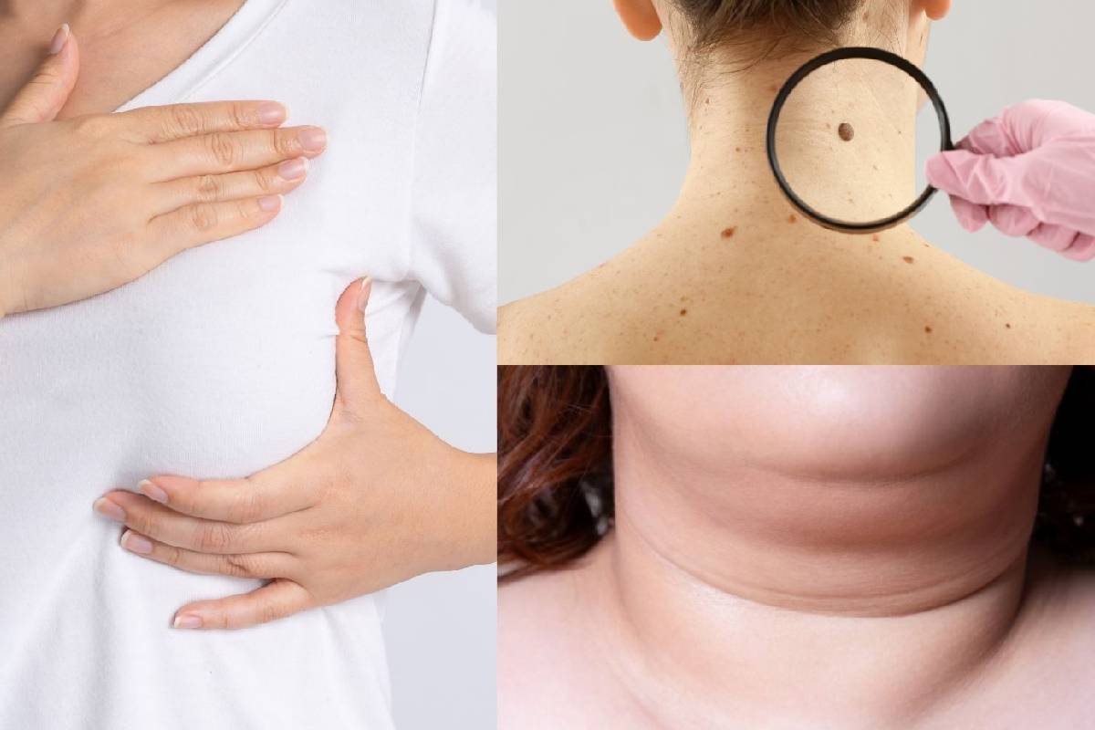 இந்த அறிகுறிகளை புறக்கணிக்காதீர்... புற்றுநோயாக கூட இருக்கலாம் | Cancer Symptoms In Tamil