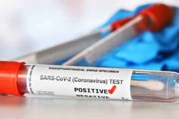 வவுனியாவில் ஒரு வயது குழந்தை உட்பட 36 பேருக்கு கொரோனா