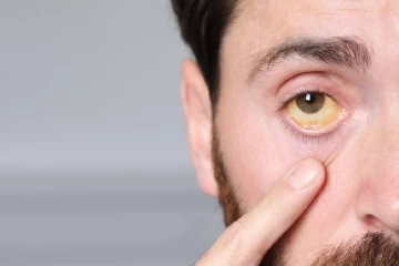 ඇස් කහ පාටට හුරු වෙලාද? මේ රෝග ලක්ෂණ තියෙනවා නම් භයානකයි දැන්ම වෛද්‍යවරයෙක් හමුවෙන්න