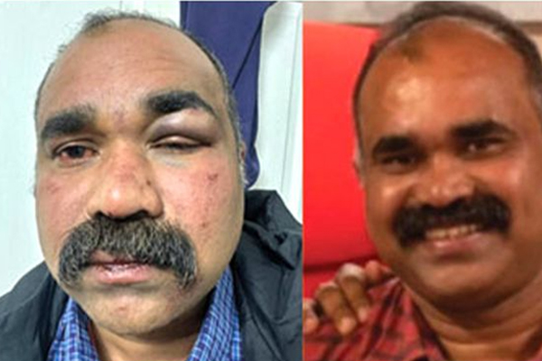 ஸ்கொட்லாந்தில் இந்தியர் மீது இனவெறி தாக்குதல் | Racist Attack On Indian In Scotland