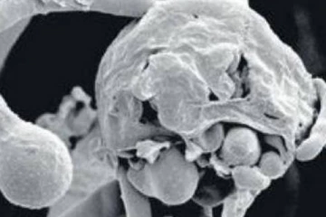 புதிதாக பரவும் மஞ்சள் பூஞ்சை! இந்த அறிகுறிகள் இருந்தா உஷாரா இருங்க மக்களே!