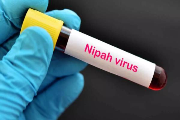 நிபா வைரஸ் அச்சுறுத்தல் - மிகுந்த எச்சரிக்கையுடன் அவதானிக்கும் இலங்கை | Health Minister Sri Lanka Prepared For Nipah Virus