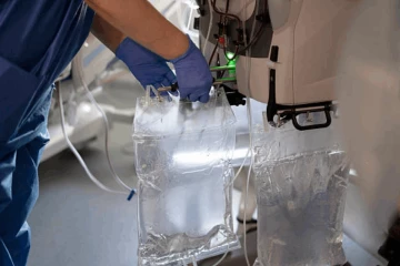 ඩයලයිසිස් ද්‍රාවණ බෑග් ලක්ෂ 8ක් ගෙන්වන්න කැබිනට් අනුමැතිය