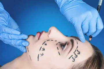 Plastic Surgery செய்யப் போறீங்களா?