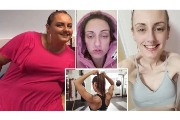 ஜிம்...டயட் என 120 கிலோவில் இருந்து 47 கிலோ எடை குறைத்த பெண்ணுக்கு நேர்ந்த கதி!