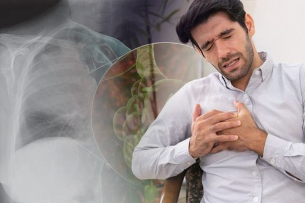 உலகை மிரட்டும் புதிய நோய் - ஆர்ஜென்டினாவில் 4 பேர் பலி | Legionnaires Disease Symptoms History Argentine