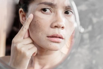 அழகான முகத்தில் ஆங்காங்கே கரும்புள்ளிகள் காணப்படுதா? இதனை போக்க இதோ சில சூப்பரான டிப்ஸ்