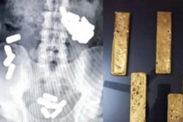 ஆசன வாய்க்குள் தங்கம் கடத்திய நபர்கள்: எக்ஸ்ரேவில் தெரியவந்த உண்மை