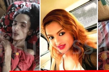 සමාජ මාධ්ය සංවේදී කළ, සුරූපී තරුණියට ඇත්තටම සිද්ධ වුණු දේ ? කවුරුත් නොදැන හිටපු කතාව මෙන්න