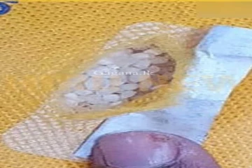 අනේ අම්මපා මෙහෙමත් මගඩියක්..අහිංසක මිනිස්සුන්ටනේ මේ වංචාව..