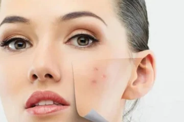 பருக்களால் வரும் தழும்பை போக்கனுமா?  இரவு நேரத்தில் இதை செய்தாலே போதும்!