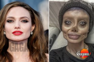 සුරූපී ඇන්ජලීනා ජොලිට මොකක්ද මේ වුණේ?