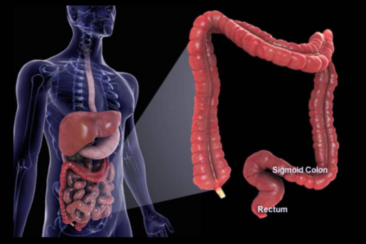 வாயில் இந்த அறிகுறிகள் இருக்கா? அப்போ பெருங்குடல் புற்றுநோய் இருக்கு | Colon Cancer Causes Symptoms On Mouth