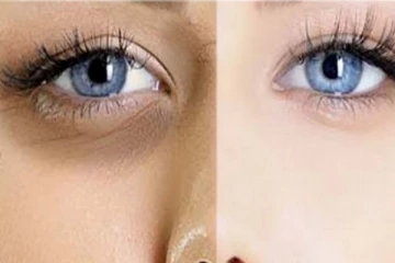 கருவளையம் சீக்கிரம் மறையனுமா? இதை பண்ணுங்க போதும்!