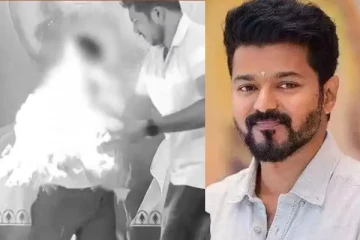 விஜய் பிறந்த நாள் கொண்டாட்டத்தில் நடந்த விபரீதம்.. சிறுவனுக்கு ஏற்பட்ட தீ காயம்!!
