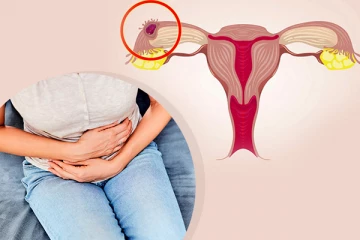 ගර්භාෂයෙන් පිටත ගැබ්ගැනීම් ඇති වන්නේ ඇයි?