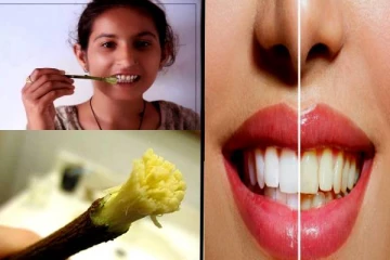 பற்களின் ஆரோக்கியத்திற்கு வேப்பிலை- இனி இத பயன்படுத்துங்க