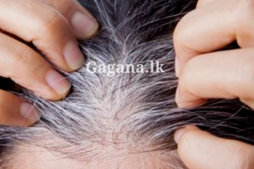 සුදු කෙස් නිසා ඇත්තටම සිත් තැවුලෙන් ද හිටියේ?. සුදු කෙස් විනාඩි 5න් නැති කරන විශ්මිත දේශීය සත්කාරය ගැන ඇහුවොත් ඔබ පුදුම වේවී...