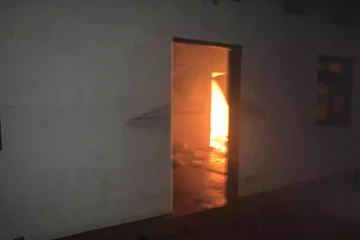 யாழில் துண்டிக்கப்பட்ட கையை சத்திரசிகிச்சை மூலம் பொருத்திய வைத்தியர்