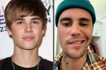 பாப் பாடகர் ஜஸ்டின் பீபர் முகத்துக்கு என்ன ஆச்சு! அதிர்ச்சியில் பல கோடி ரசிகர்கள்..