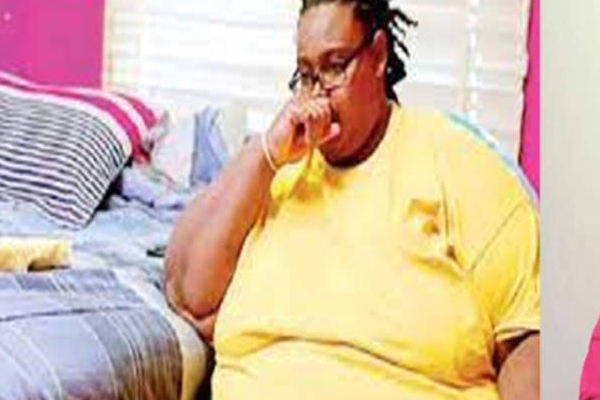 20 ஆண்டுகளாக மொத்தைகளை உண்ணும் அமெரிக்க பெண்! | Us Woman Has Been Eating Junk Food For 20 Years