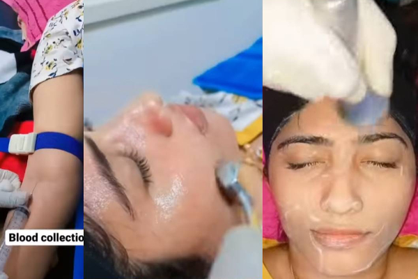 ரத்தத்தில் அழகு சிகிச்சை! பேரழகியாக மாறிய பிக் பாஸ் ஜூலி - இப்போ எப்படி இருக்கின்றார் தெரியுமா? | Bigg Boss Juli Viral Video