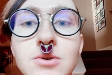 தற்கொலை செய்துகொண்ட ஹிட்லரின் மறுபிறவி நான்: தழும்பை ஆதாரமாக காட்டும் இளைஞர்